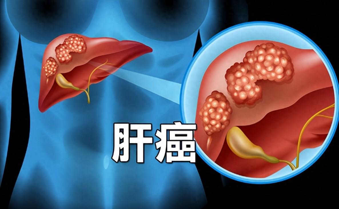补硒能降血糖(硒的作用及食物来源)-硒宝网