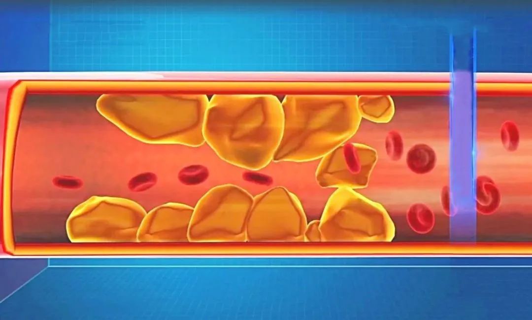 甲亢补硒的药()-硒宝网