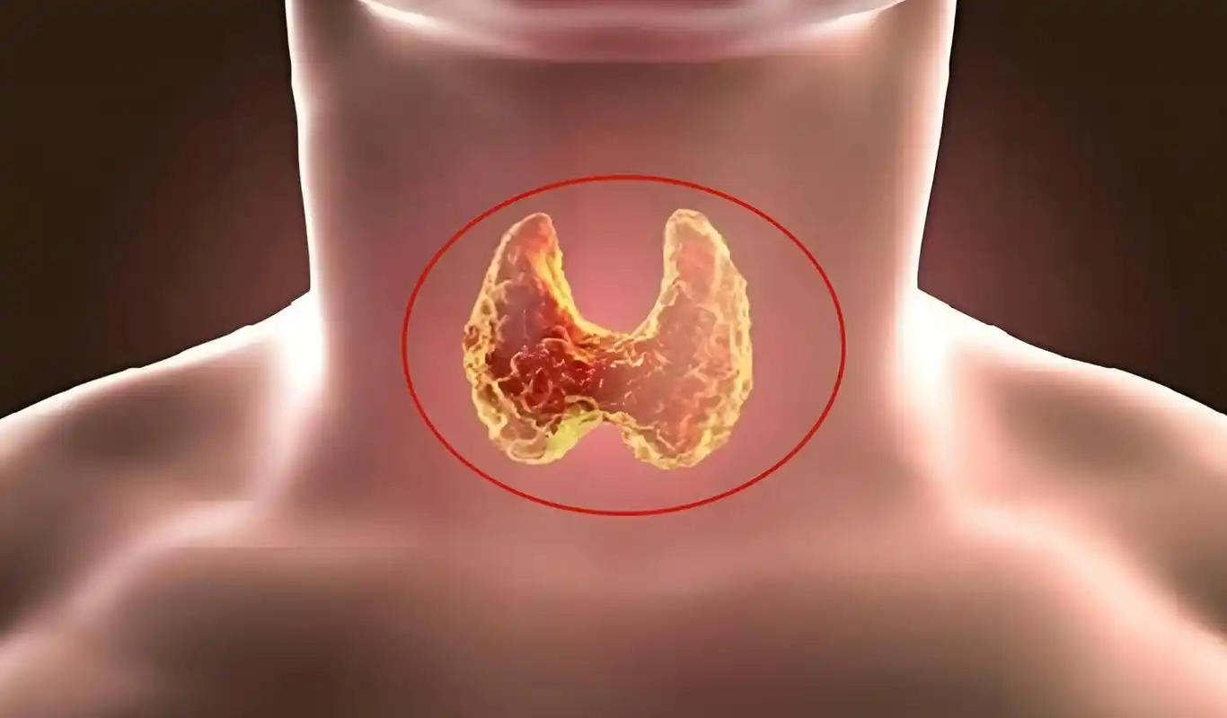 销售补硒话术(甲状腺健康饮食)-硒宝网