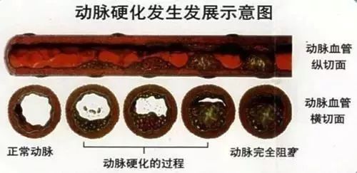 补硒药怎么吃(补硒对血管的好处)-硒宝网