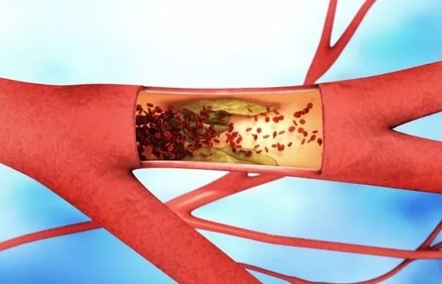 补硒药怎么吃(补硒对血管的好处)-硒宝网