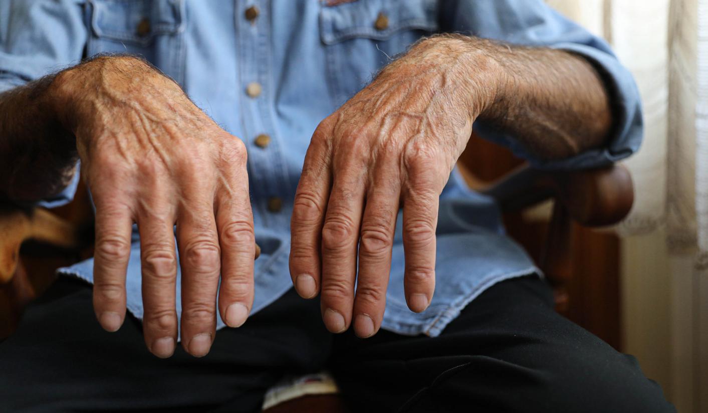 护肝如何补硒（硒缺乏症状）-硒宝网