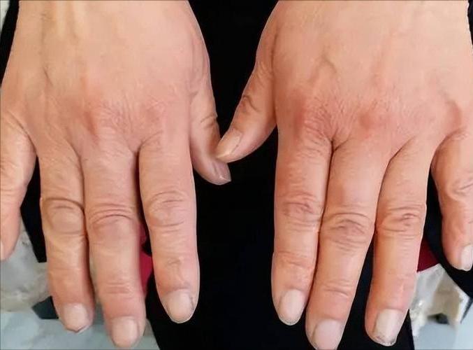 螃蟹能补硒吗（硒与免疫系统功能）-硒宝网