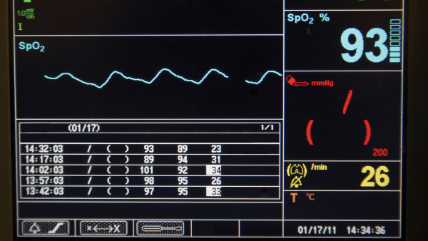 桥本需补硒吗(硒对桥本甲状腺炎的帮助)-硒宝网