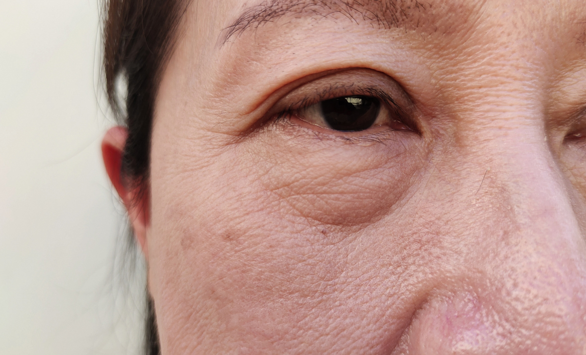 需补硒的人群（富含硒的食物有哪些）-硒宝网